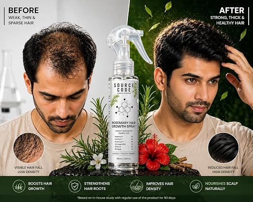 Rosemary Hair Spray (200ml) – For Hair Growth, Stronger, Thicker & Shinier Hair