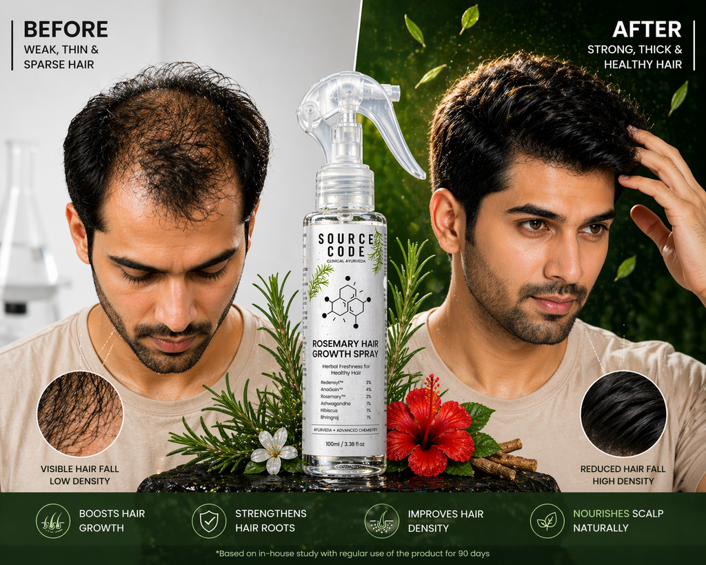 Rosemary Hair Spray (100ml) – Stronger, Thicker & Shinier Hair