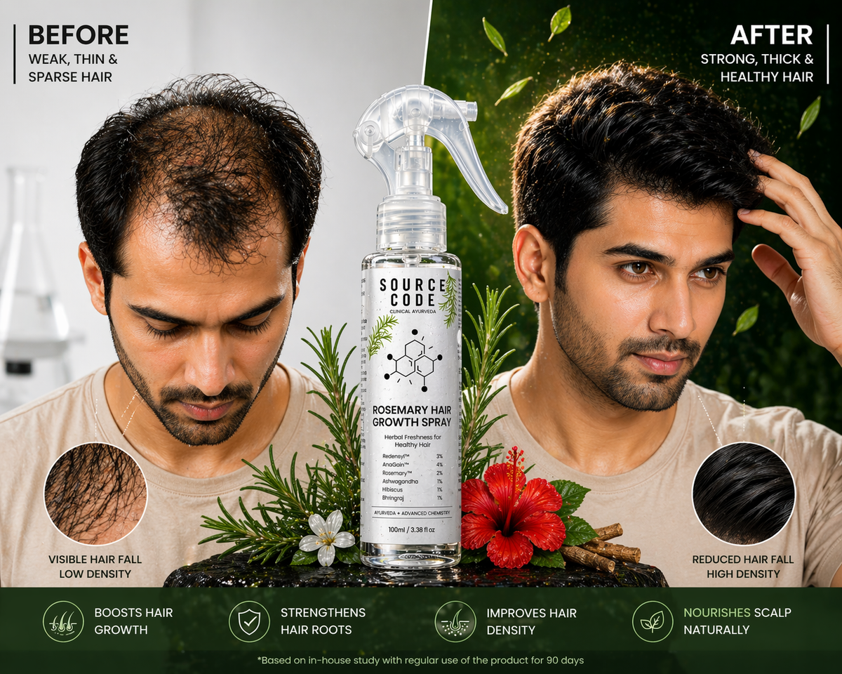 Rosemary Hair Spray (100ml) – Stronger, Thicker & Shinier Hair