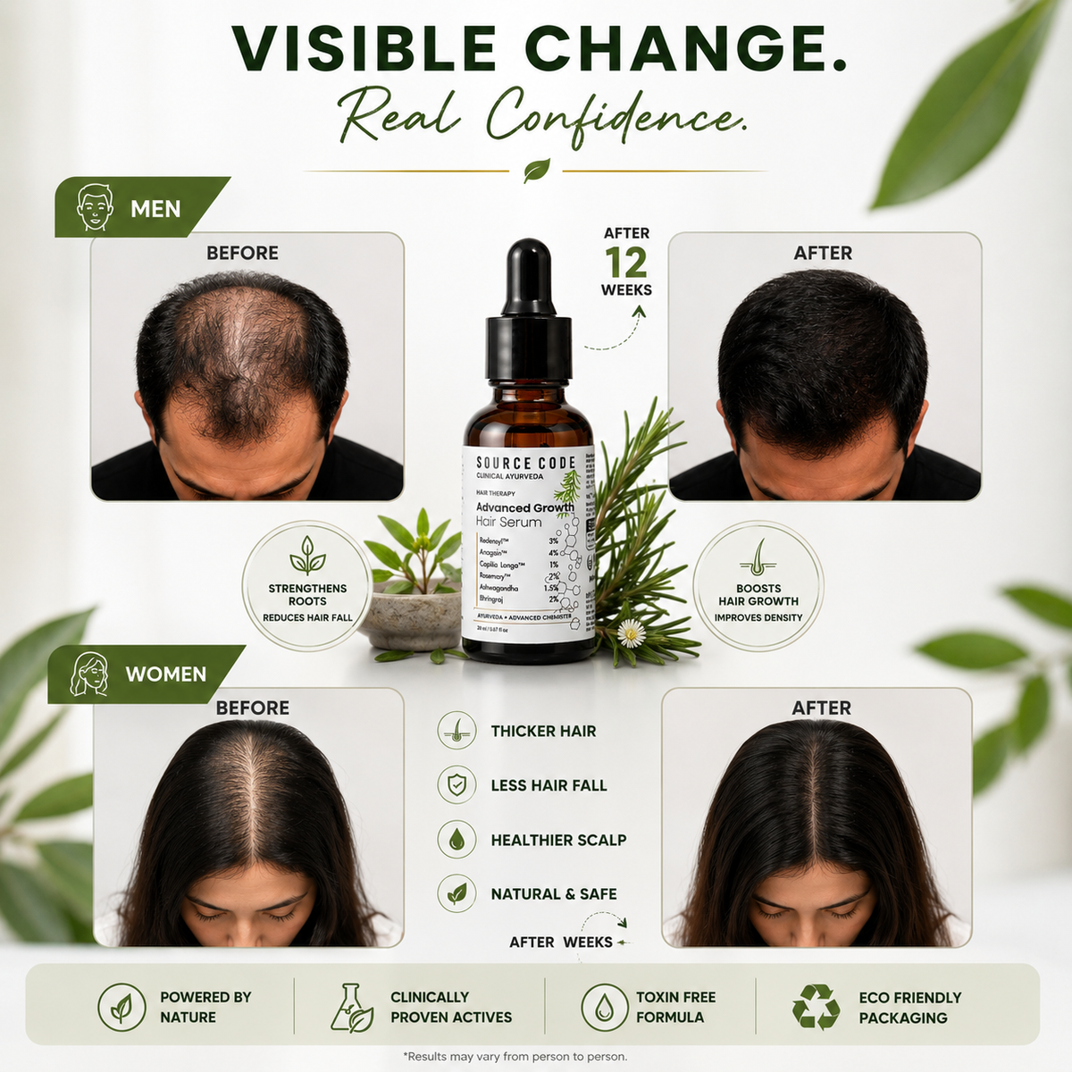 Advanced Hair Growth Serum